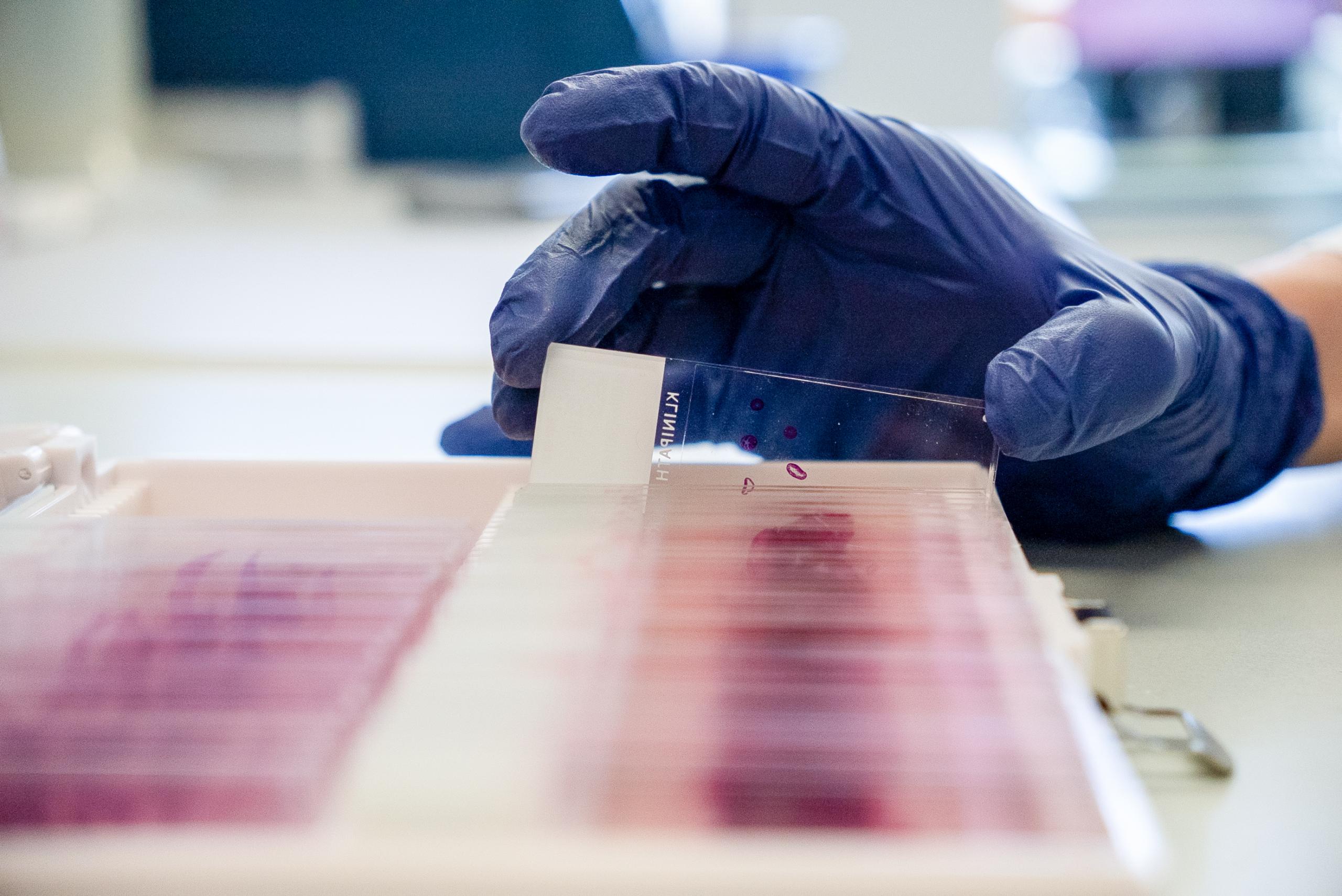 Tissue slides stained using immunohistochemistry techniques.